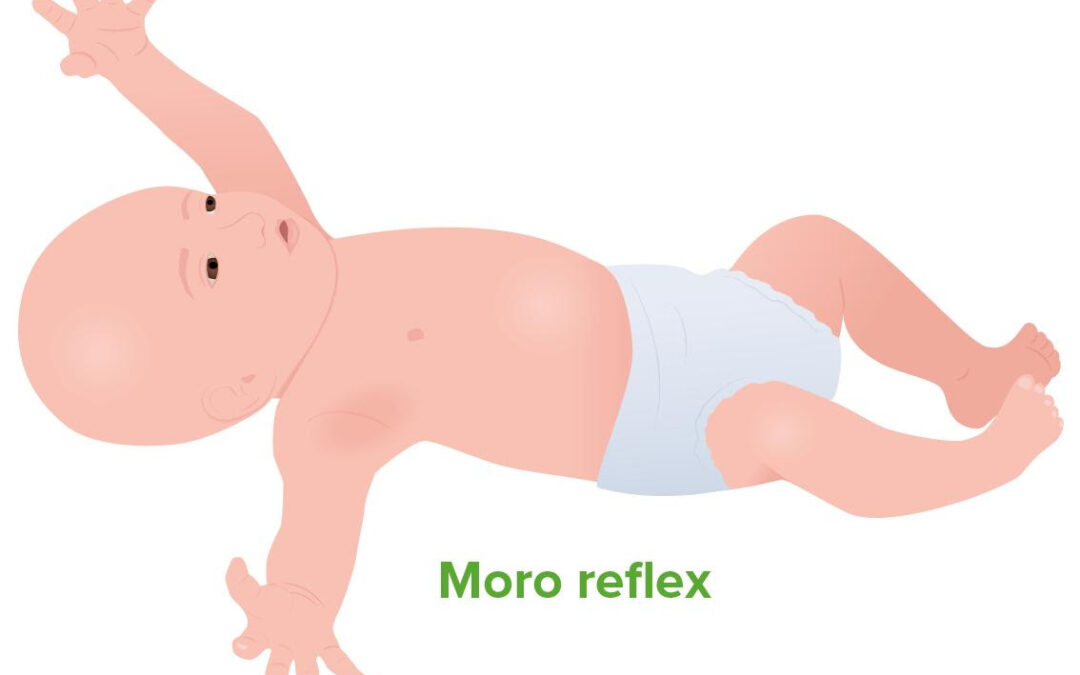 Primitive Reflexes in Children: What They Are, When They Should Disappear, and What Happens If They Don’t