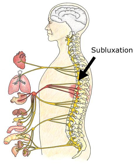 Subluxation: What It Is, Why It Matters, and How It Affects the Expression of Life